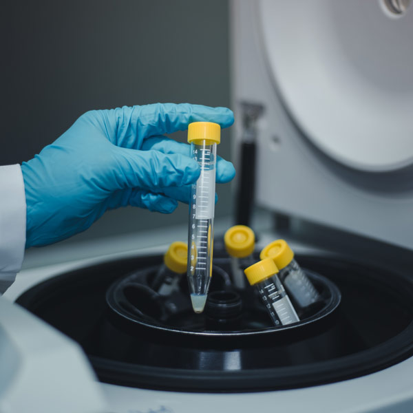 hand removing test tube from centrifuge
